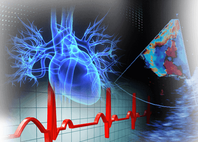 angiocardioneurologia